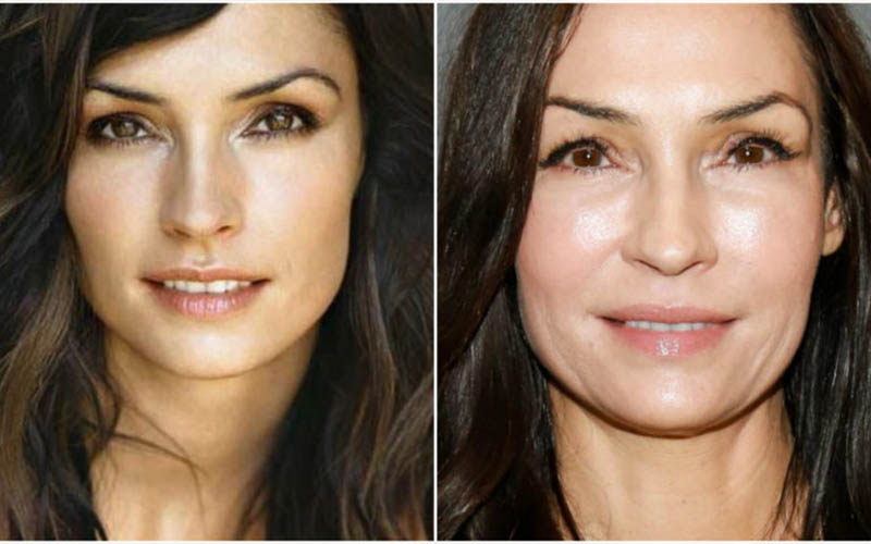 Famke janssen plastic surgery